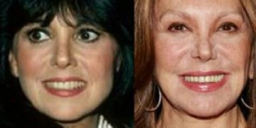 Marlo Thomas’s makeover with plastic surgery: before and after