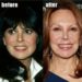 Marlo Thomas’s makeover with plastic surgery: before and after